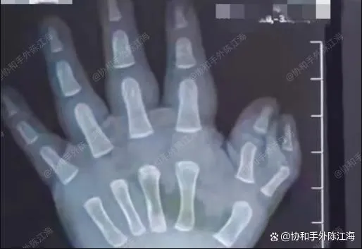 info-514-353 info-514-353